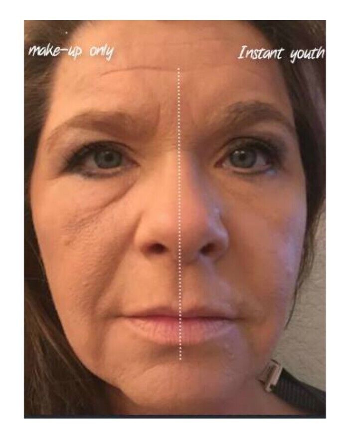✨ Ageless Renewal – The Secret to Radiant, Youthful Skin ✨