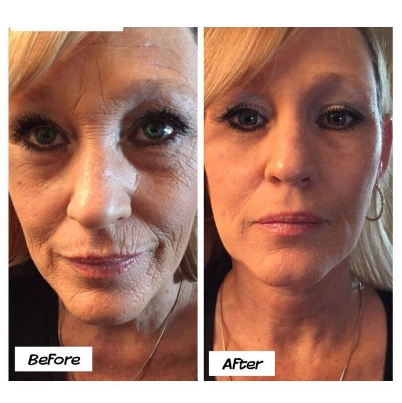 ✨ Ageless Renewal – The Secret to Radiant, Youthful Skin ✨